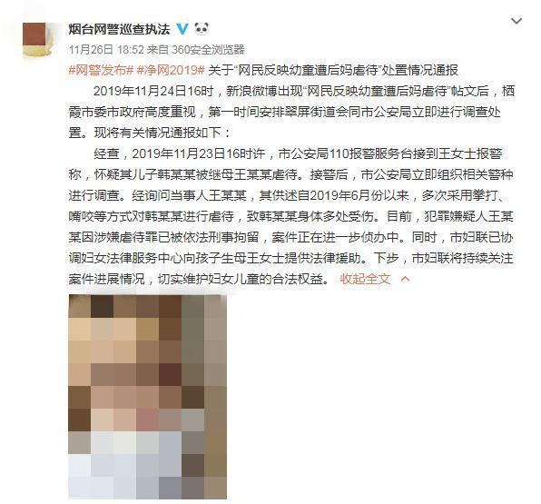 山东烟台一幼童遭继母虐待 警方：嫌疑人已被刑拘