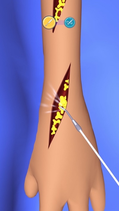 外科手术大师截图