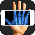 手机扫描骨骼x光